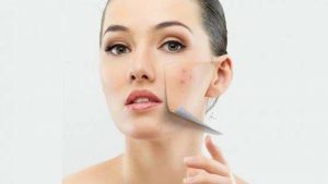 mascarilla de cafe con leche para el acne