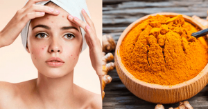 mascarilla con cúrcuma para desmanchar la piel